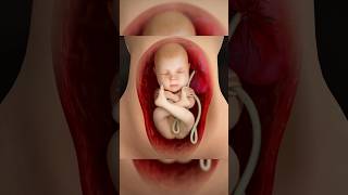 Reason Behind CSections  Breech Position 3D Animation csectionrecovery 3danimation [upl. by Jennifer171]