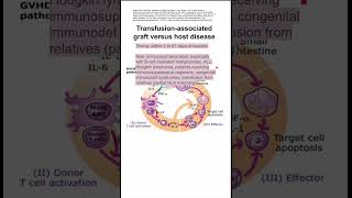 Transfusionassociated graft versus host disease [upl. by Arakihc321]