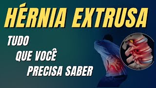 Hérnia de Disco Extrusa  Como Resolver [upl. by Weirick]