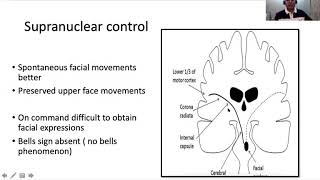 Facial nerve examination in children simplifed [upl. by Reisinger]