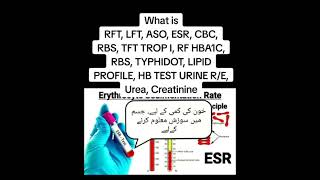 Most common laboratory test Names and their indications [upl. by Yot]