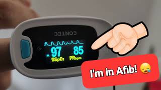 How my pulse oximeter tells me when I have Atrial fibrillation  aFib  AF  not a EKG or ECG [upl. by Isla]