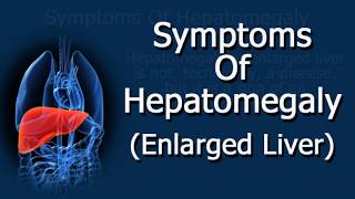 Symptoms Of Hepatomegaly Enlarged Liver [upl. by Elimay]