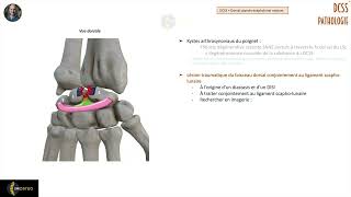 Imagerie des pathologies du DCSS [upl. by Nedrah555]