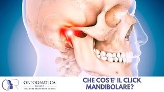 La mandibola scricchiola cosè il click mandibolare [upl. by Hpotsirhc]