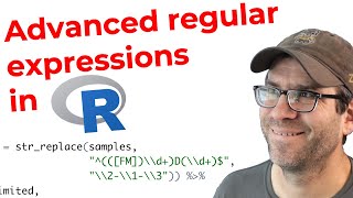 Creating an advanced regular expression in R with strreplace and separate CC184 [upl. by Ayal84]