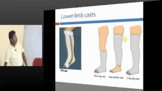 NEETPG Coaching Orthopedics Topic 01 Fractures Part 01 [upl. by Jovitah]