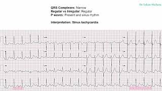 ECG Course  4 Tachyarrthmia [upl. by Nitsua730]