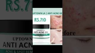 Anti acne Gelyoutubeshortsyoutubeytshortsshopping [upl. by Clemence805]