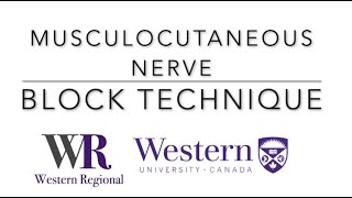 Musculocutaneous nerve block ultrasound nerveblock pain anesthesia [upl. by Elagibba]