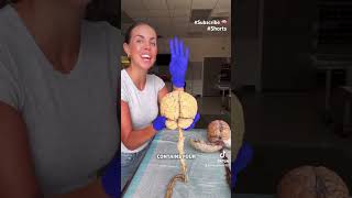 Human Brains 🧠 donated to Medical science tiktok foryou foryoupage shorts viral subscribe [upl. by Iris254]