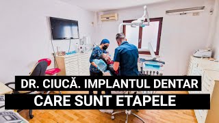 ETAPELE UNUI IMPLANT DENTAR Ce trebuie să știi [upl. by Saqaw]