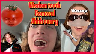 Hippies Wisdom teeth removal [upl. by Thenna]