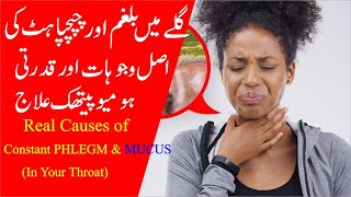 Real Causes of Constant PHLEGM amp MUCUS In Your Throat and Its Homeopathic Treatment [upl. by Nuhsar674]