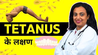 Tetanus Symptoms  Tetanus Ke Lakshan Kya Hote Hai [upl. by Aland]