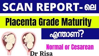 Placenta Grade in Scan Report Malayalam  Placenta Position [upl. by Oscar]