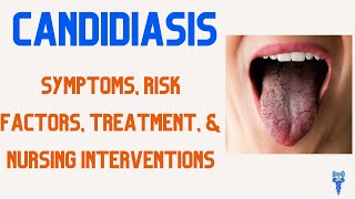 CANDIDIASIS SYMPTOMS Risk Factors Treatment amp Nursing Care [upl. by Ahsiekahs]