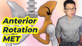 FIX Forward Pelvic Rotation with these techniques [upl. by Yenruogis]