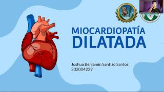 Miocardiopatía Dilatada Chagásica Dr Ext Joshua Santizo [upl. by Ardeen]