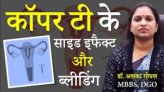 कॉपर टी के नुकसान और फायदे  Copper T Kaise Lagai Jaati Hai  Copper T Side Effects in Hindi [upl. by Clary]