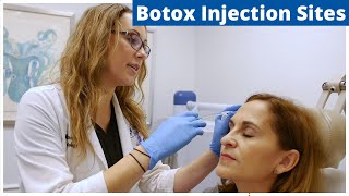 Botox Frontalis Glabella amp Nefertiti Treatment  Botox Injection Sites [upl. by Lirret]