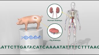 Pigtohuman kidney transplant 3D animation [upl. by Nadbus55]