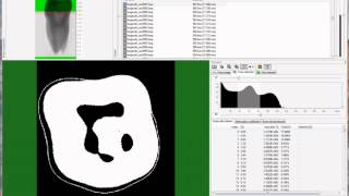 MicroCT morphometry of the tooth part 2 enamel and dentine [upl. by Mchail156]