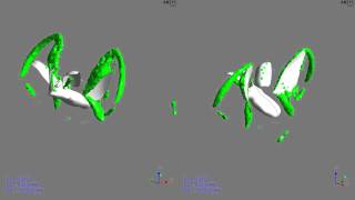 Flying beetle CFD  swirling strength [upl. by Hayward]