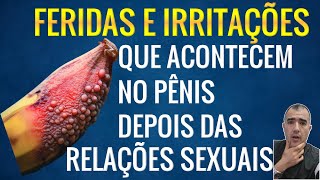 Causas de feridas e irritações no pênis após as relações sexuais [upl. by Noek471]