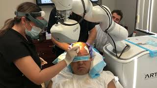 Artas Robotic Hair Restoration Procedure Beverly Hills Hair MD 2022 [upl. by Iolanthe]