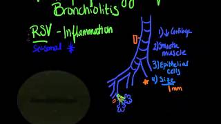 bronchiolitis pathophysiology clayton and berro [upl. by Melinde]