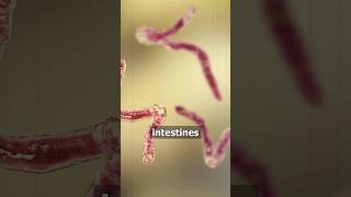 Worms can infest your body hookworms parasites health naturopathy body shorts [upl. by Midian]