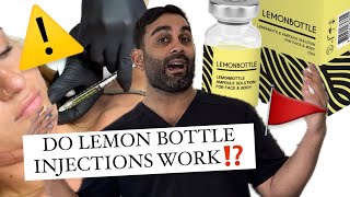 Lemon Bottle WHY YOU SHOULD AVOID IT [upl. by Otis979]