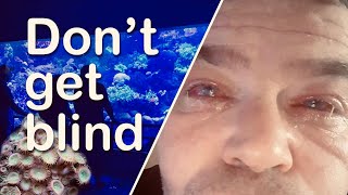 Dont Get Blind Because of a Reef Aquarium [upl. by Eceinhoj]