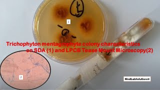 Trichophyton mentagrophyte colony characteristics on SDA and LPCB Microscopy [upl. by Pavel]