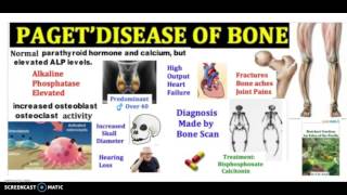 What is Pagets Disease of bone in 3 minutes Symptoms Pathophysiology and Treatment [upl. by Vidal805]