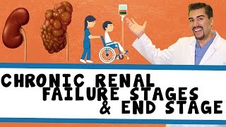 Chronic Renal failure stagesamp End stage renal failure Part 1 [upl. by Esaj]