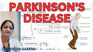 Parkinsons Disease Akinesia Rigidity Tremors [upl. by Kingsbury]