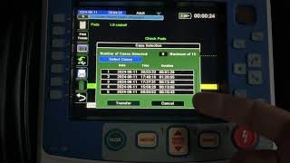 Moving Data from the ZOLL X Series Advanced to ImageTrendZOLL X Series Tips and Tricks [upl. by Daph303]