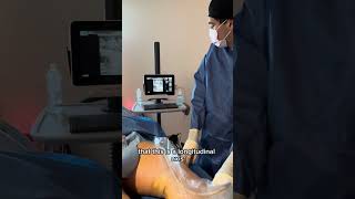 Lipedema Reduction Surgery on patients Calves with Dr Wright lipedema [upl. by Horodko681]