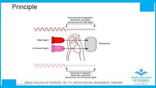 Basics to Pulseoximetry and Plethysmography [upl. by Maxfield47]