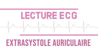 Interprétation ECG  Extrasystole Auriculaire quotESAquot [upl. by Ahsahtan]