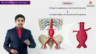 Abdominal aortic aneurysm  Usmle step 1  Causes  Signs amp symptoms  diagnosis  treatment [upl. by Ewell851]