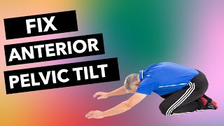 Fix Anterior Pelvic Tilt 4 Critical Exercises [upl. by Gitt355]