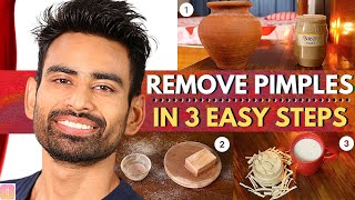 ULTIMATE Ayurvedic Routine to Get Rid of Pimples amp Acne Permanently Men amp Women [upl. by Ahsiliw]