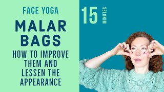 Face Yoga to Improve Malar Bags Eye Bags and Puffiness [upl. by Eniffit]