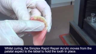 Using Simplex Rapid Acrylic to repair a denture [upl. by Neetsuj]