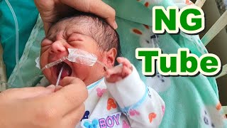 Nasogastric NG Tube Insertion in NeonateNewborn  Orogastric OG TubeFeeding Tube  Paediatric [upl. by Tuddor795]