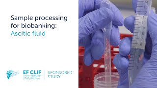 Sample processing for biobanking Ascitic fluid [upl. by Mercorr]