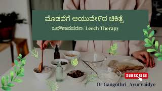 Leech Therapy for Acne  ಮೊಡವೆಗೆ ಜಲೌಕ ಚಿಕಿತ್ಸೆ [upl. by Aguayo]